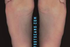 brooklynrobertscloseup