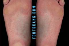 bubblegumbunnycloseup