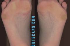 elizabelledixiecloseup