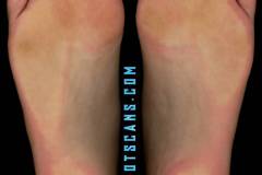 erosorishacloseup