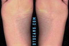 isabellasorentticloseup