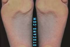 ivorymayhemcloseup