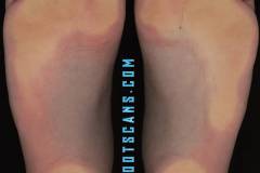 sylviesommerscloseup